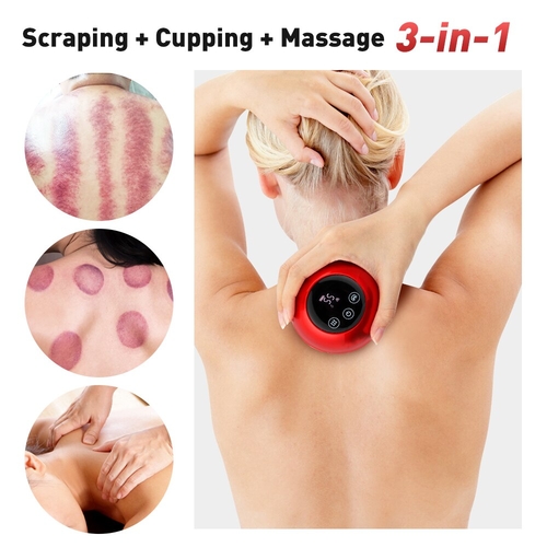 Second image of Electric Cupping Massager Vacuum Suction Cups Red Light Anti Cellulite